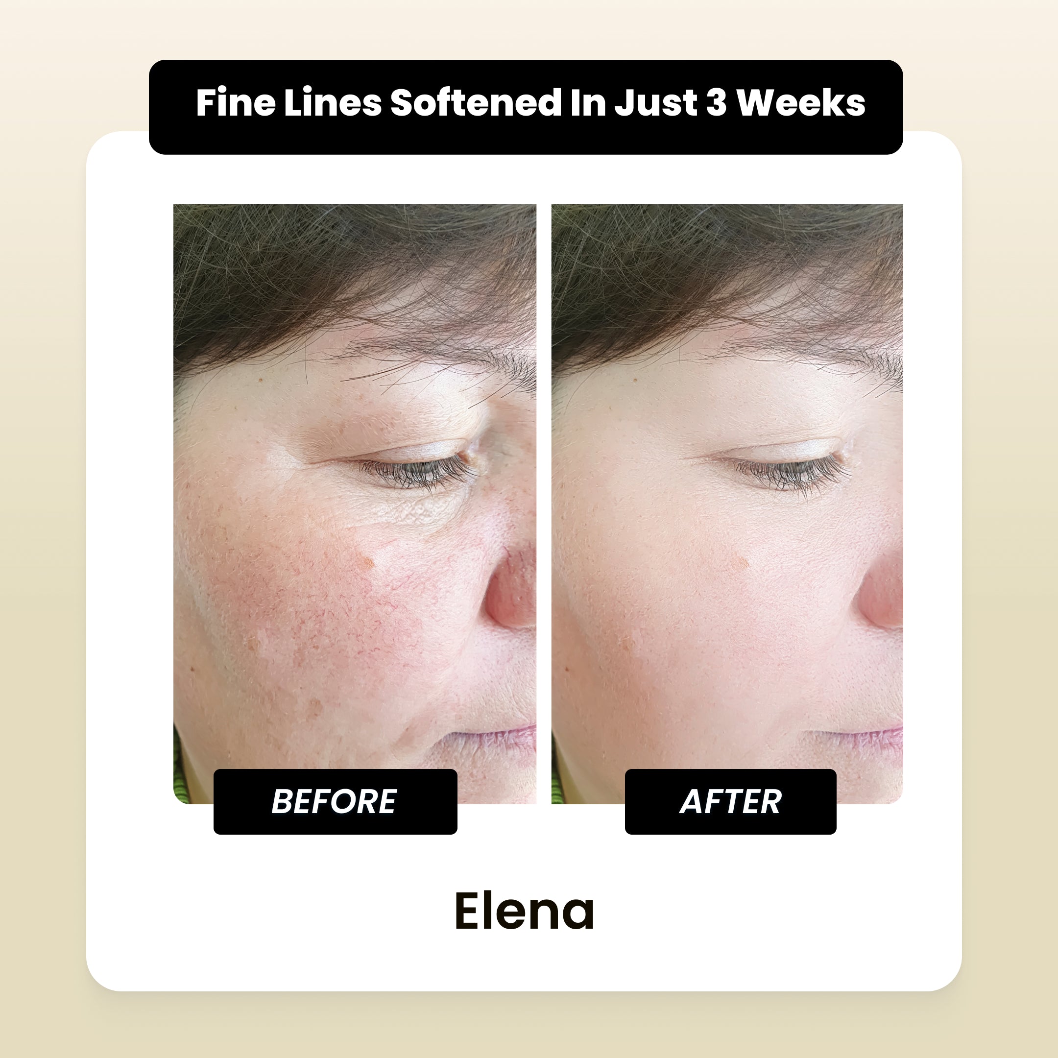 SheDiary Glutathione Cream