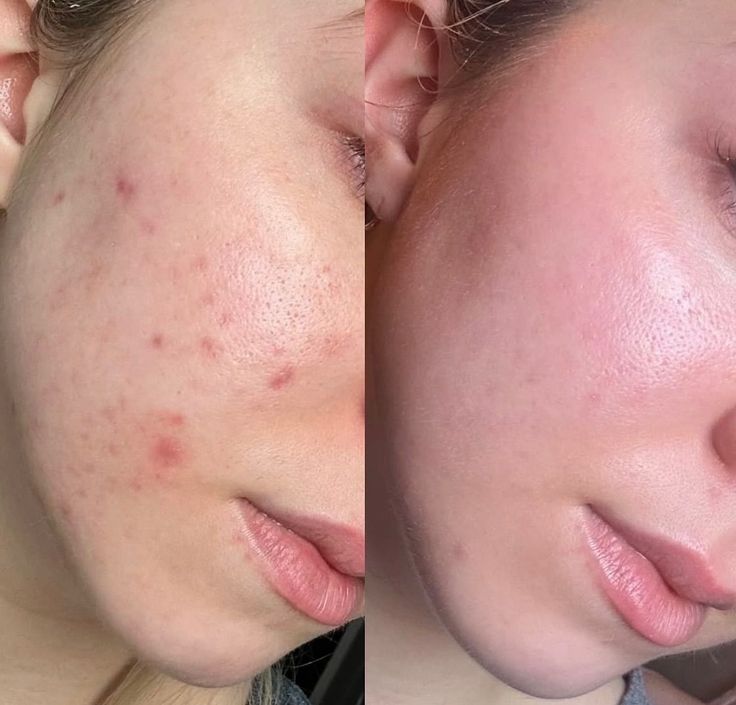 SheDiary Glutathione Cream